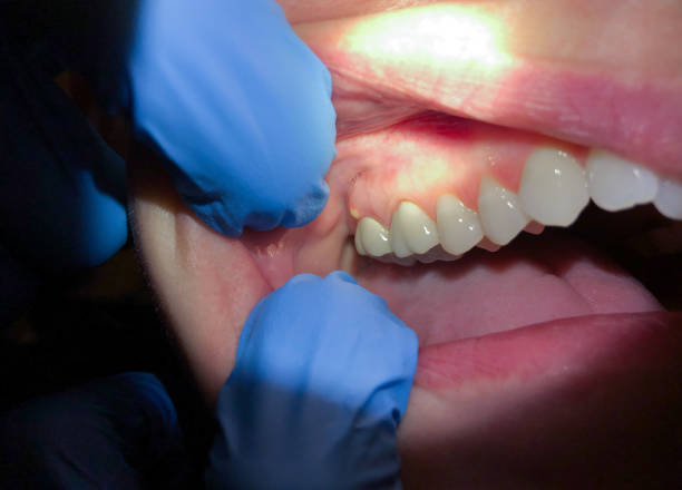 Best Pediatric Emergency Dentist in Farngton Hills, MI